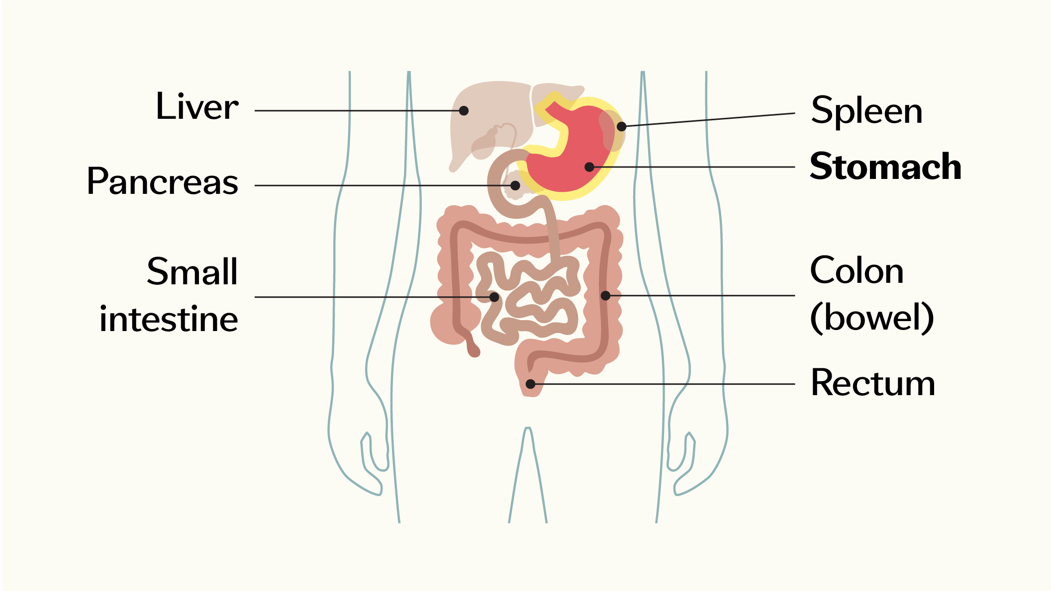 Diagram of the digestive system showing the liver, stomach, pancreas, spleen, small intestine, colon (bowel), and rectum.