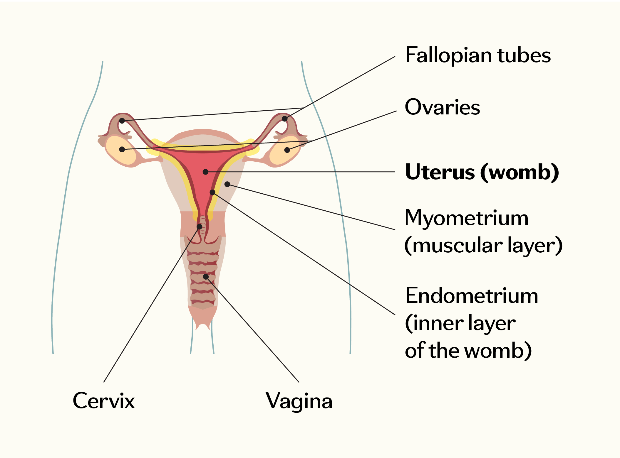 Diagram of the female reproductive system showing the fallopian tubes, ovaries, uterus (womb), myometrium, endometrium, cervix, and vagina.