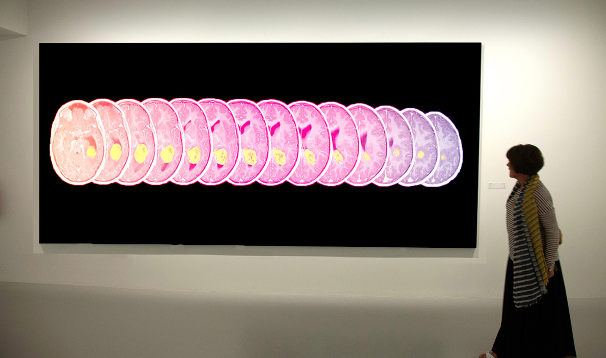 A woman stands in an art gallery observing a large, horizontal artwork depicting a series of brain scan slices arranged in a row.
