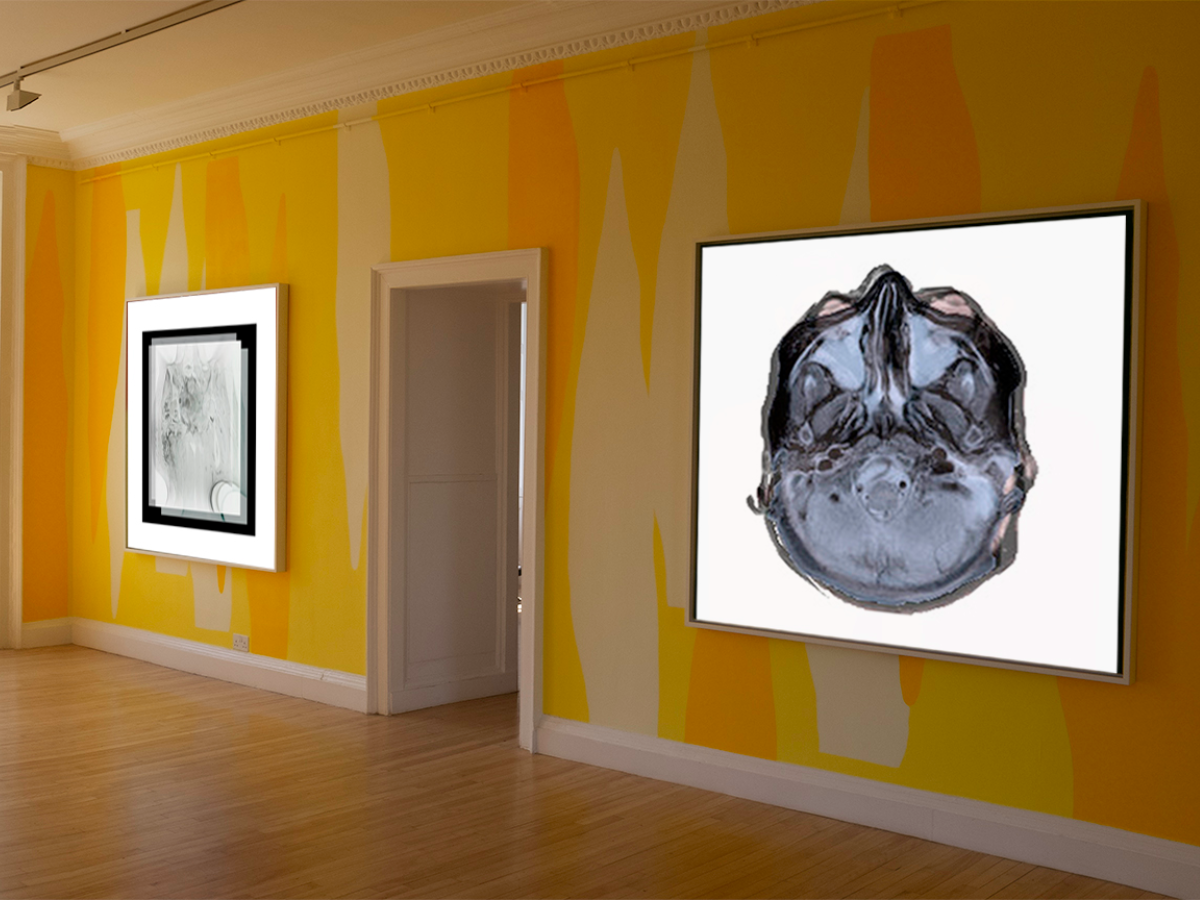 transverse brain image in exhibition 